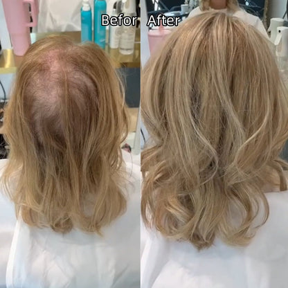🩷 Final Hours –🌷2026 New Lightweight & Breathable Wavy Hair Topper